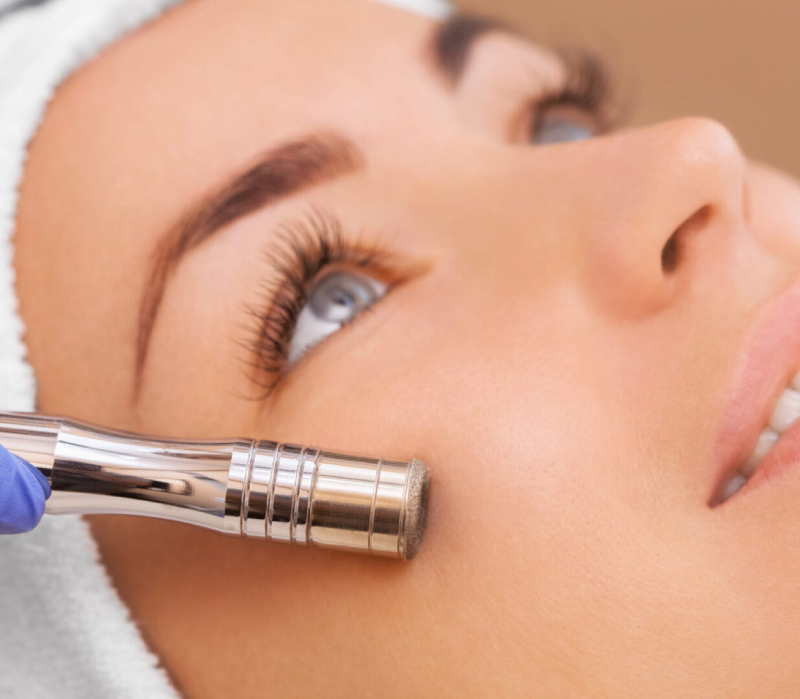 Microdermabrasion Facial