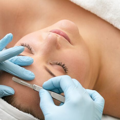 Dermaplaning Facial A woman getting her face waxed by an esthetician.