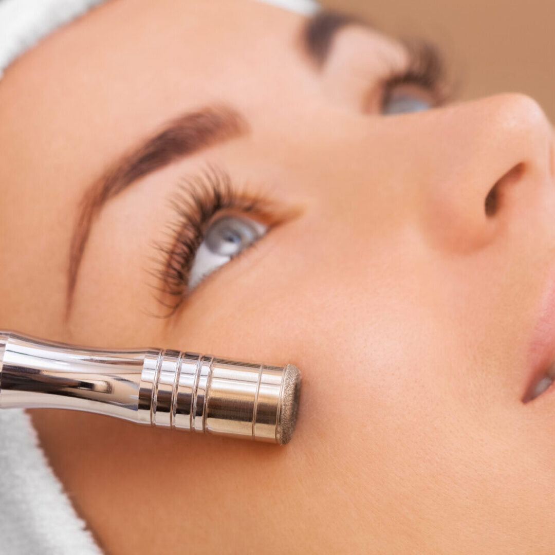 Microdermabrasion Facial A woman getting her face waxed with an electric device.