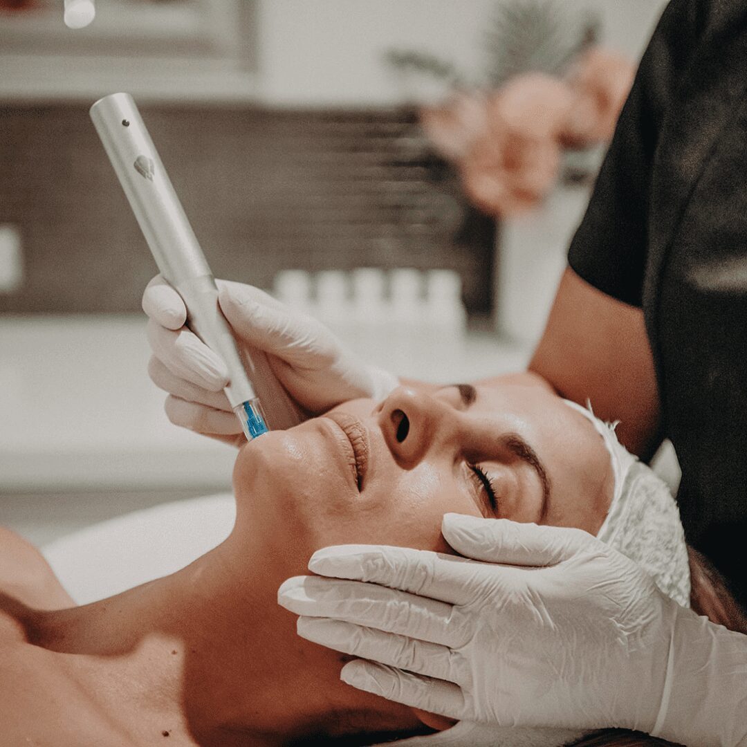 Nano-Microchanneling-circle-3b0f70b481b86902405990f8136a0bcb-g3s5npo21eml A woman getting her face waxed by an esthetician.